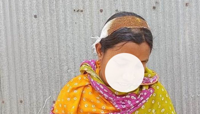 লালমনিরহাটের হাতীবান্ধায় যৌতুকের জন্য স্ত্রীর মাথা ফাটালেন স্বামী