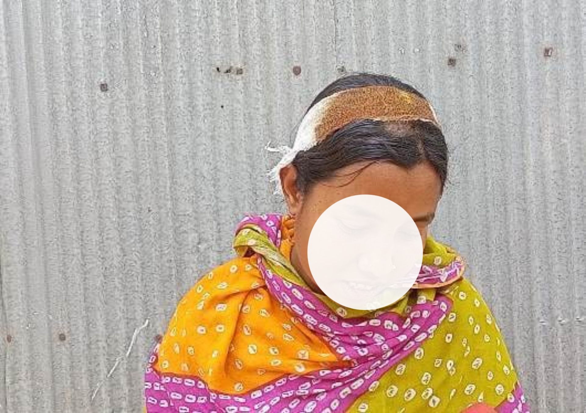 লালমনিরহাটের হাতীবান্ধায় যৌতুকের জন্য স্ত্রীর মাথা ফাটালেন স্বামী