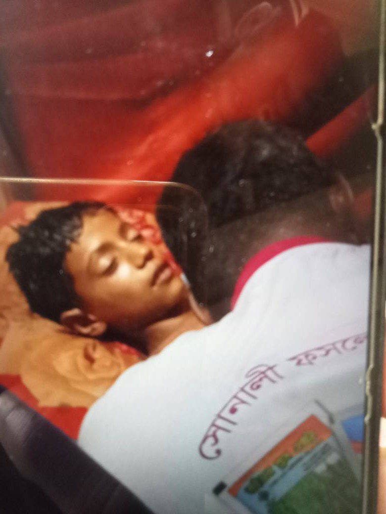 ধুনটে বজ্রপাতে শিশুর মৃত্যু