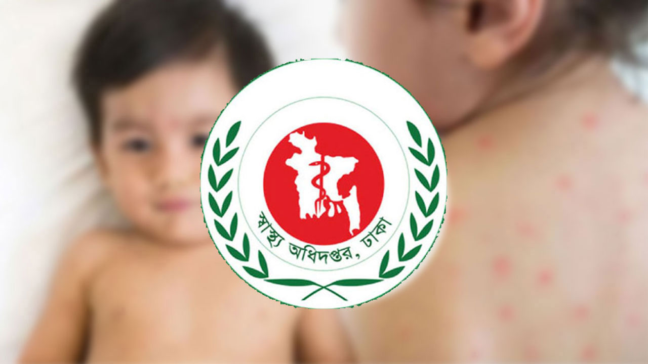হামের উপসর্গে এক দিনে ৮ মৃত্যু, আক্রান্ত ১ হাজারের বেশি